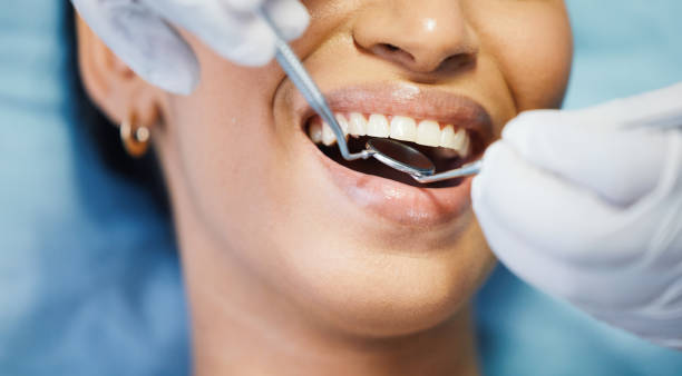Best Emergency Root Canal Treatment in Redkey, IN